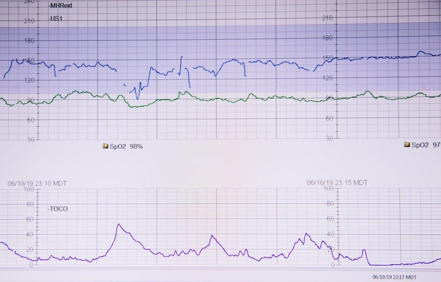 Latency vs Accuracy